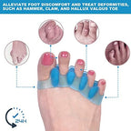 Sosede silicone gel toe spacers being worn on a foot to demonstrate alignment.