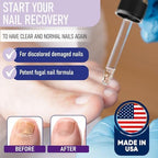 ZanaQuick liquid drops being applied to a thick, discolored toenail.