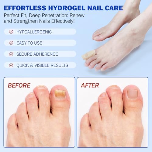 Before and after visualization of discolored nail restoration using hydrogel patches.