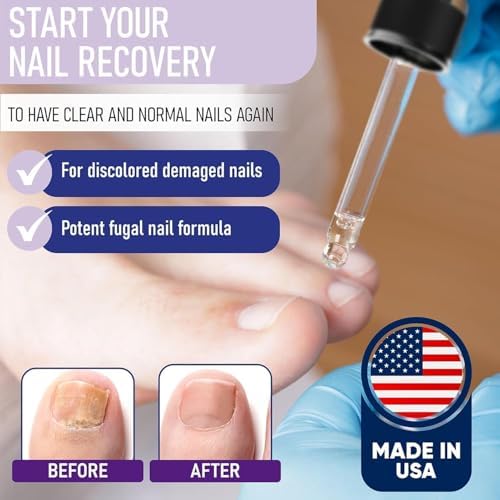 Close up of Zanaquick dropper application for damaged yellow toenails.