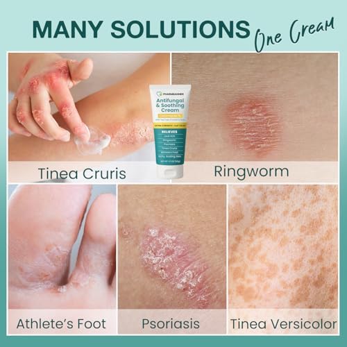 Charmpoo imported skincare relief cream for clearing skin scaling and itching from athlete foot.