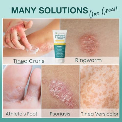 Charmpoo imported skincare relief cream for clearing skin scaling and itching from athlete foot.