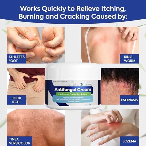 Charmpoo 2 percent miconazole nitrate cream for ringworm treatment