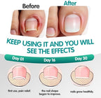 Before and after comparison using the painless at home pedicure tool for straightening curved nails.