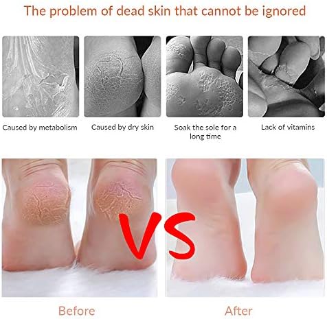 Codream stainless steel pedicure kit for salon quality foot care at home
