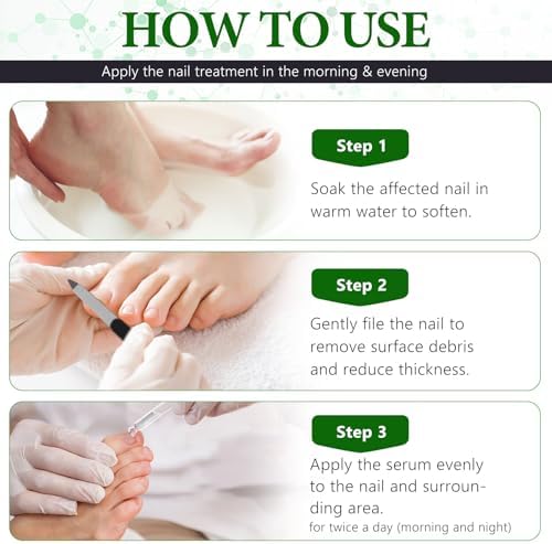Before and after comparison of brittle nails treated with OMZOK repair serum.