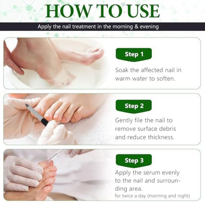 Before and after comparison of brittle nails treated with OMZOK repair serum.