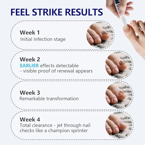 Authentic USA imported iKeener nail repair treatment for onychomycosis.