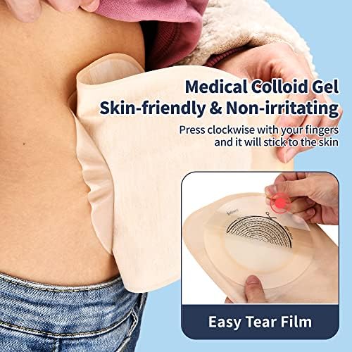The drainable bottom opening and secure closure mechanism of the Jctracy ileostomy pouch.