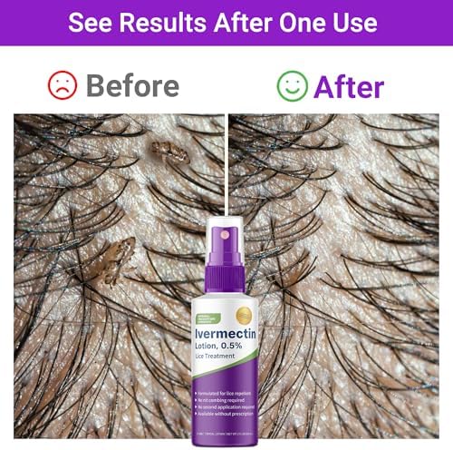 Side view of Shunniub Ivermectin topical lotion for head lice