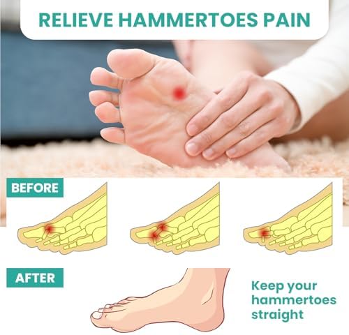 Welnove medical grade gel pads for correcting crooked and overlapping toes.