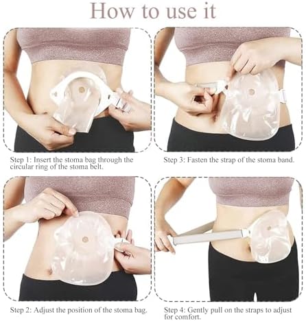 Beige color tone of JFRHUDS ostomy support belt for discreet wear