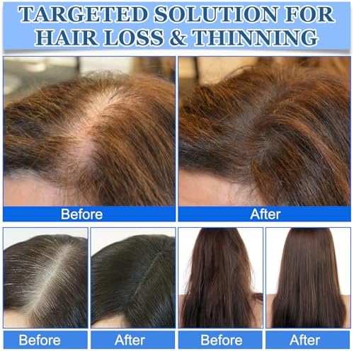 Demonstration of the non-greasy lightweight hair serum being applied directly to the hairline.