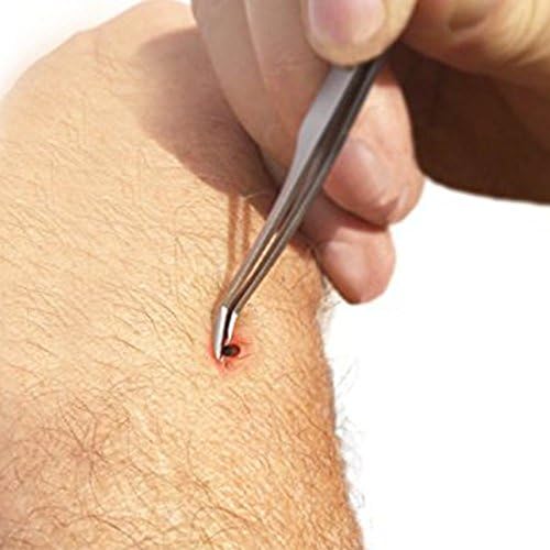 Etradewinds stainless steel tick removal kit ready for travel