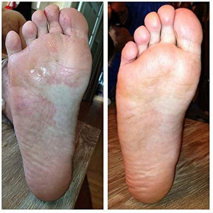 Authentic Imperial Feet packaging for the 150ml advanced foot and shoe deodorizer.