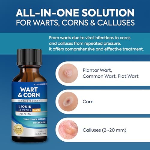 Uikeaft salicylic acid treatment for corn and callus removal on heels and toes.