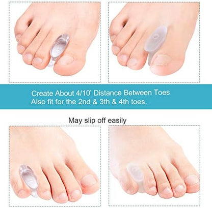 Transparent gel toe separators being worn to show bunion pain relief.