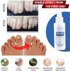 Anti-itching and deodorizing spray for daily foot hygiene and odor control.