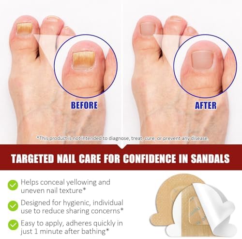 Infographic showing the 8-hour release technology of Accio fungal nail patches.