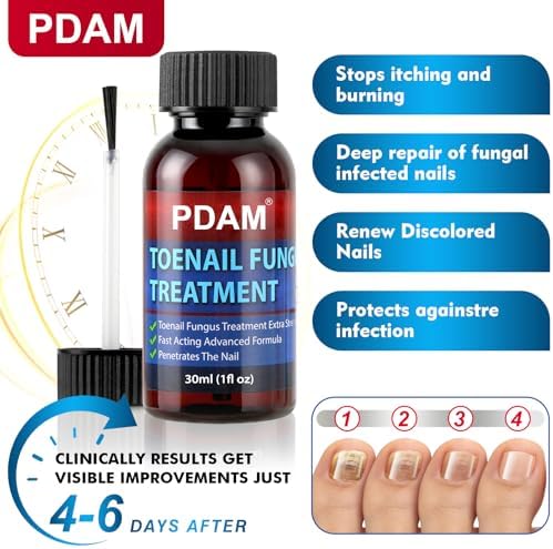 PDAM topical solution for thick and discolored nails
