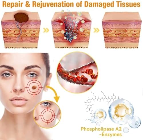 MORKORIA fast acting bee venom treatment applied to skin tag on neck