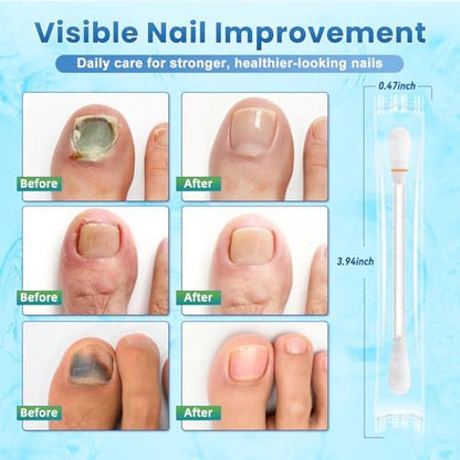 Close up of 25 percent Undecylenic Acid and 1 percent Tolnaftate ingredients on product box.