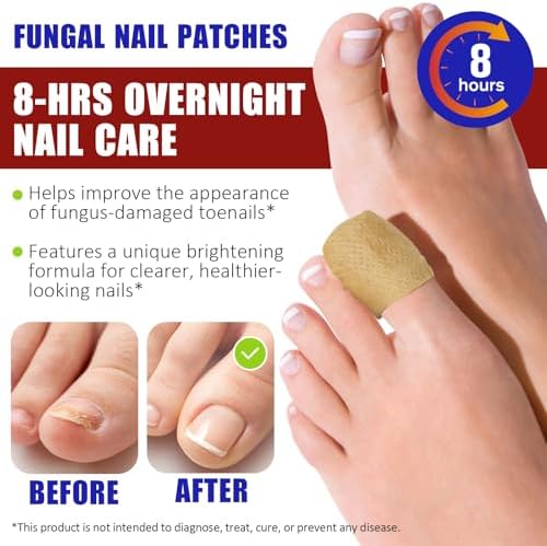 Close up of a hydrogel fungal nail patch being applied to a discolored toenail.