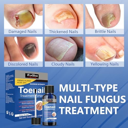 Drawzone nail repair liquid being applied to a thick toenail with brush