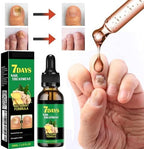 Imoll nail growth serum packaging and bottle display