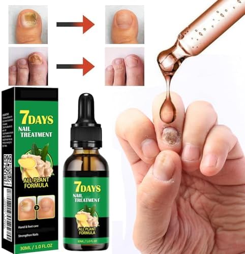 Turmeric infused nail oil providing assistance with strengthening thin and weak nails