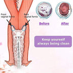 Medical grade BPA-free manual pressure pump for intimate hygiene control.