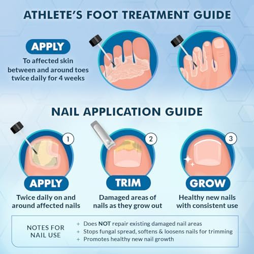 Ebanel 2 percent Miconazole Nitrate cream for itchy and cracked feet