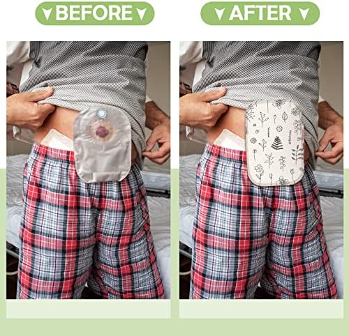 Weewooday reusable ostomy bag covers showing the skin friendly fabric texture.