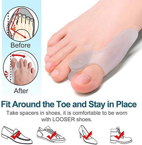 Washable and reusable silicone gel spacers for overlapping toes