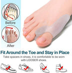 Washable and reusable silicone gel spacers for overlapping toes