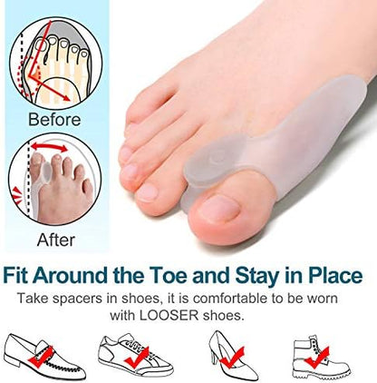 Washable and reusable silicone gel spacers for overlapping toes