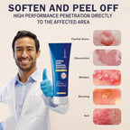 Imported MEOLY skin treatment ointment for genital and plantar warts.