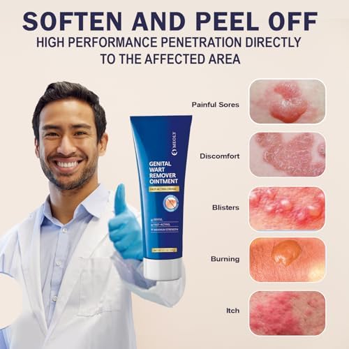 Imported MEOLY skin treatment ointment for genital and plantar warts.
