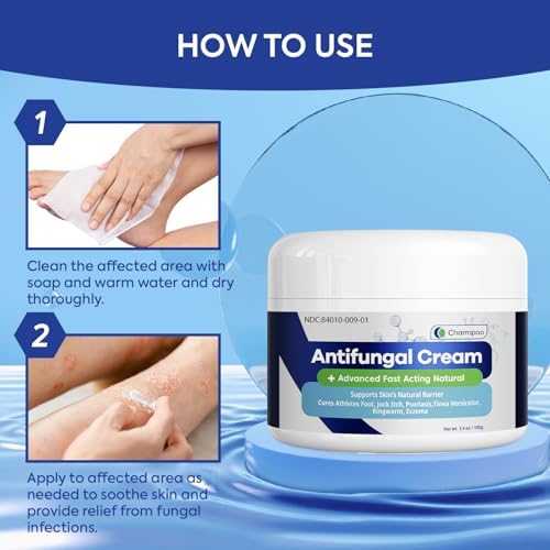 Extra strength antifungal ointment for athletes foot relief 100g