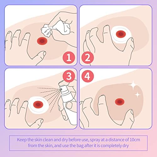 Heagimed model F40P alcohol free stoma care spray for daily protection