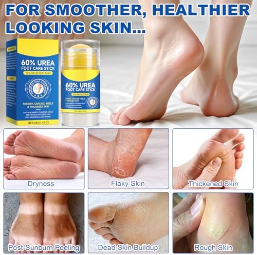 Solid glide on foot care moisturizer stick for rough elbows knees and hands