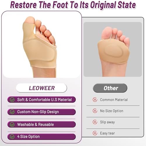 Side profile of the beige metatarsal pad showing the low profile design for shoes.