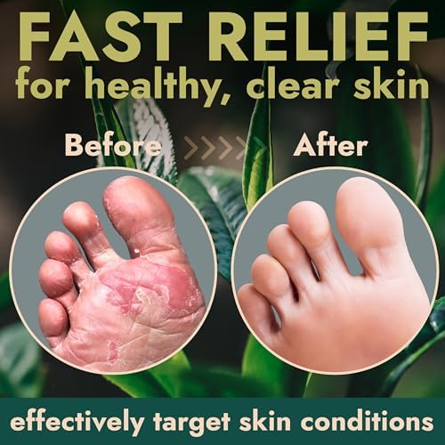 USA imported Terramed skin treatment for itching and burning relief