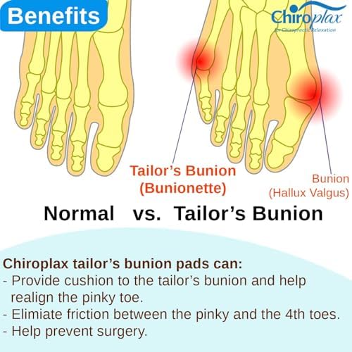 Ambidextrous design of Chiroplax bunionette pads for left and right feet