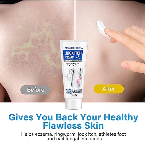 iTecFreely fast acting inner thigh itch cream for men and women