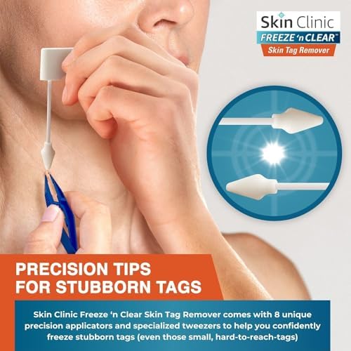 Skin Clinic skin tag remover contents including the aerosol canister and applicator tools.