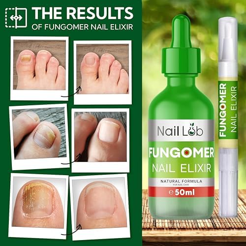 Premium nail fungus treatment set showing 50ml bottle and travel pen