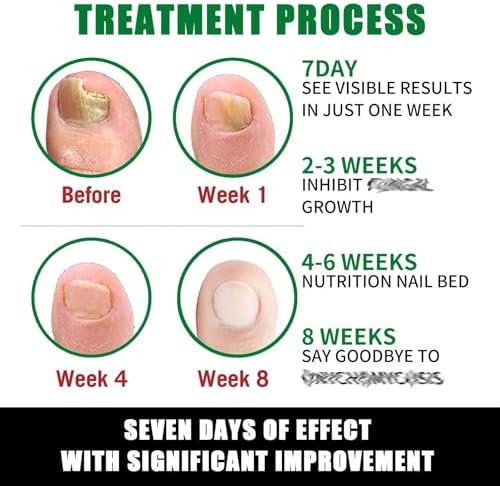 IMOLL professional nail care products works to provide assistance with long nails