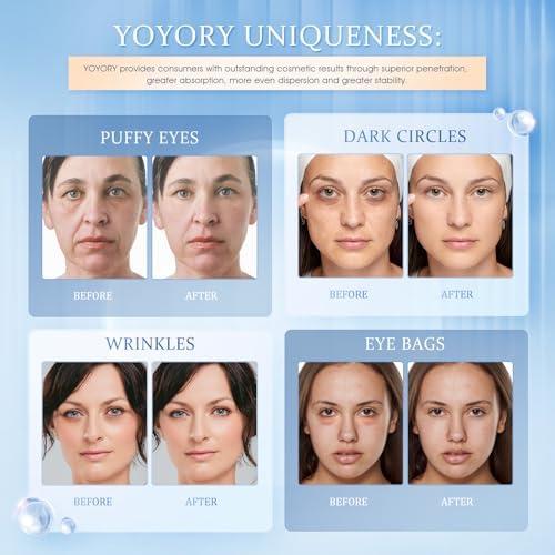 Close up of YOYORY cooling gel eye pads infused with hyaluronic acid