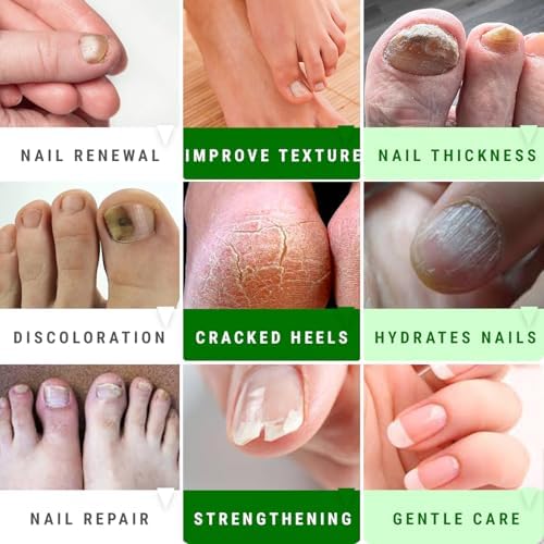 Scientific Solutions Global professional strength nail repair gel packaging